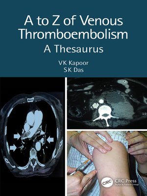 cover image of A to Z of Venous Thromboembolism